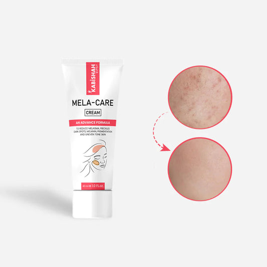 Mela Care Advanced Brightening Cream For Skincare(60ml)